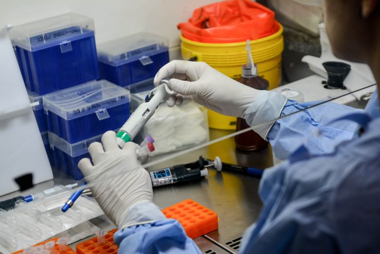 Governo vai aumentar capacidade de exames diários de coronavírus